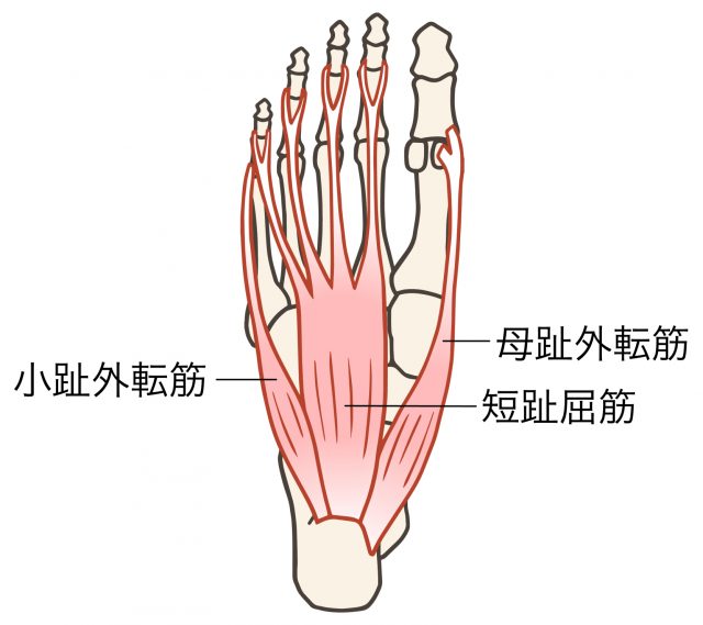 足底筋膜　足底腱膜