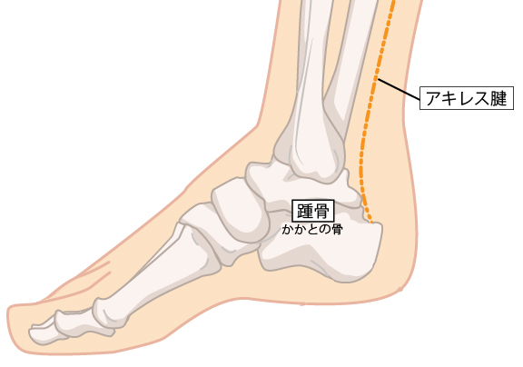 アキレス腱