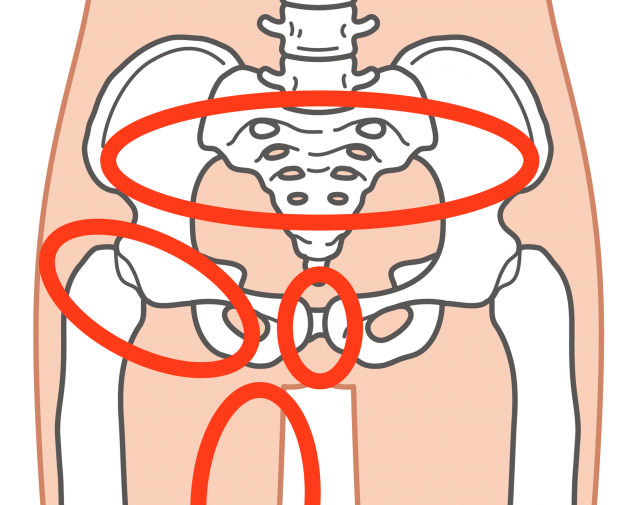 グロインペイン症候群　痛み箇所