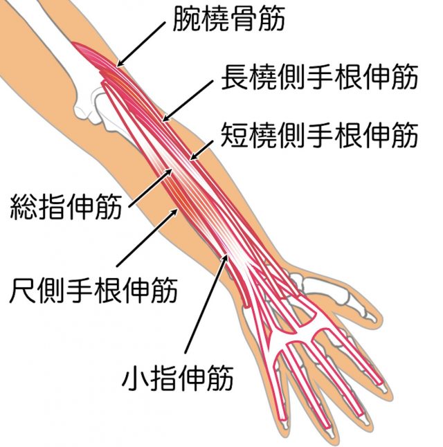 上腕骨外側上顆　テニス肘　伸筋群　腕橈骨筋　橈側手根伸筋　指伸筋