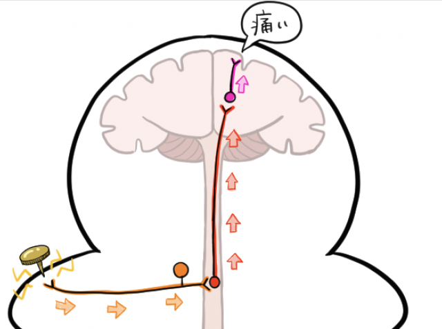 画鋲　刺さる　痛み