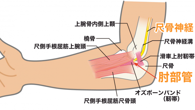 肘部管症候群　尺骨神経