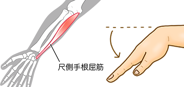 尺側手根屈筋