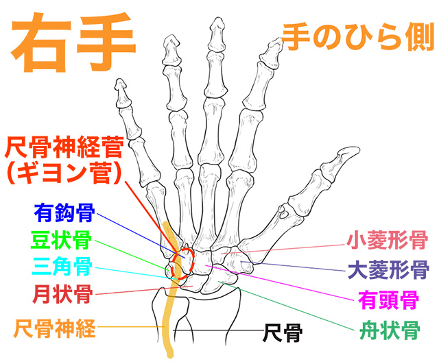 ギヨン管症候群　尺骨神経