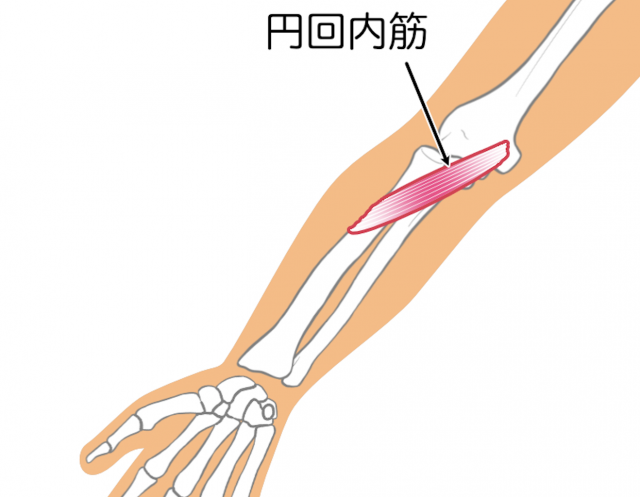 正中神経　円回内筋
